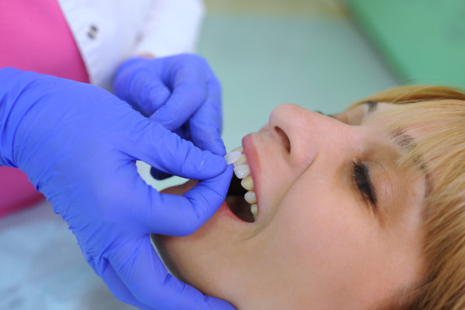 tips-for-maintaining-your-dental-crown