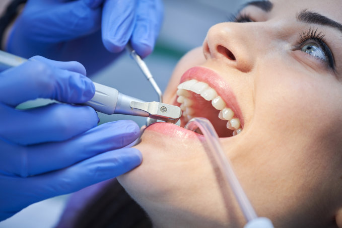 what-you-need-to-know-before-root-canal-treatment